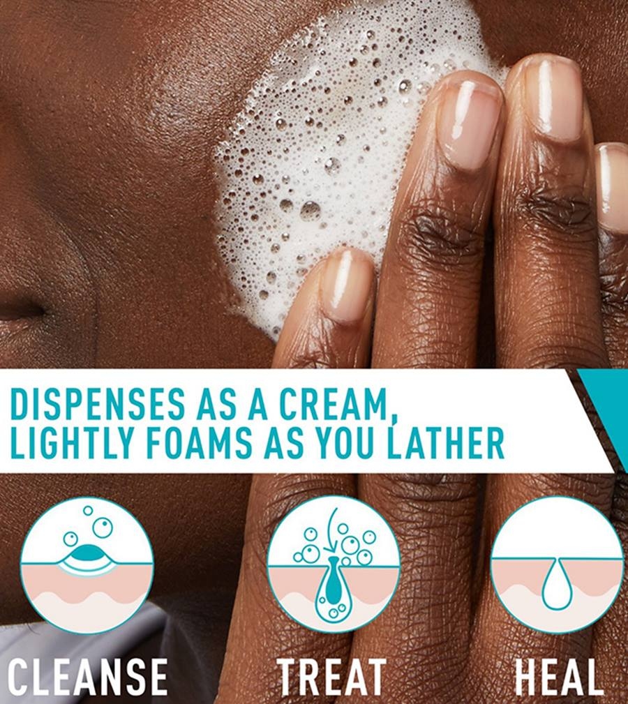 Cerave Acne Foaming Cream Cleanser (150ml) , Cerave Cleanser For Acne Problem , Cerave face wash Acne Facewash Acnes Facewash , Moisturizer Cream Oil Cleanser, Face Cleanser, Cera Ve Cleanser, Cera Ve Acne Cleanser 3
