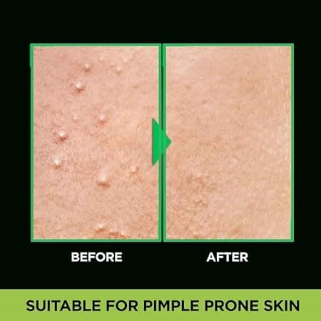 Garnier Men Acno Fight Anti Pimple Face Wash 100 G, Anti Pimple Face Wash with Salicylic Acid 3