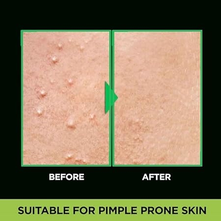 Garnier Men Acno Fight Anti Pimple Face Wash, Anti Pimple Face Wash with Salicylic Acid 4