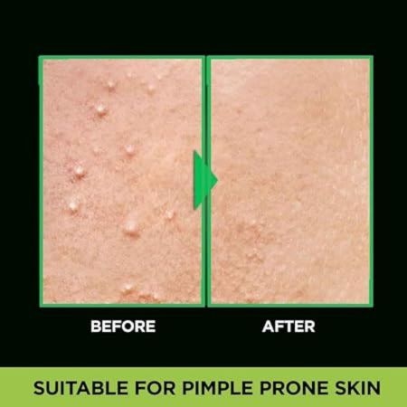 Garnier Men Acno Fight Anti Pimple Face Wash 150 G 4