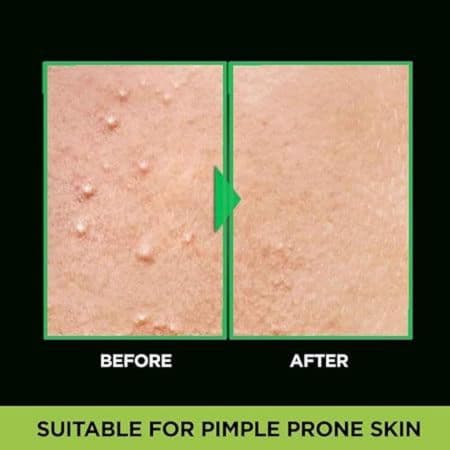 Garnier Men Acno Fight Anti Pimple Face Wash 150 G 3