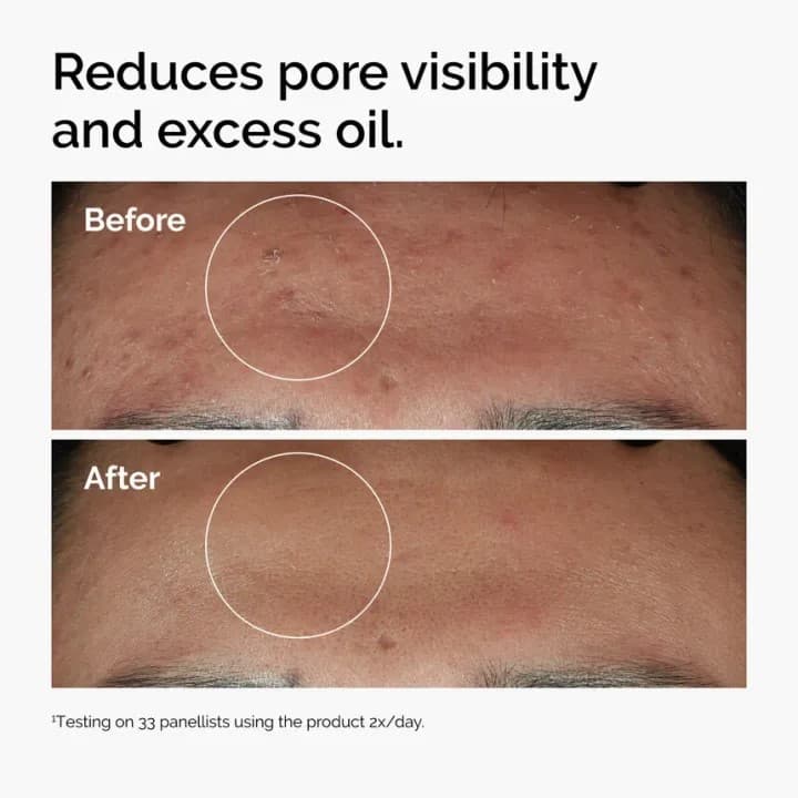The Ordinary Niacinamide 10% Zinc 1% Serum 30 ML 1