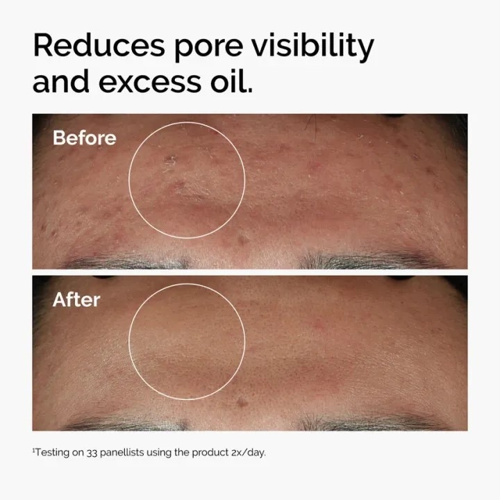 The Ordinary Niacinamide 10% Zinc 1% Serum 30 ML 2