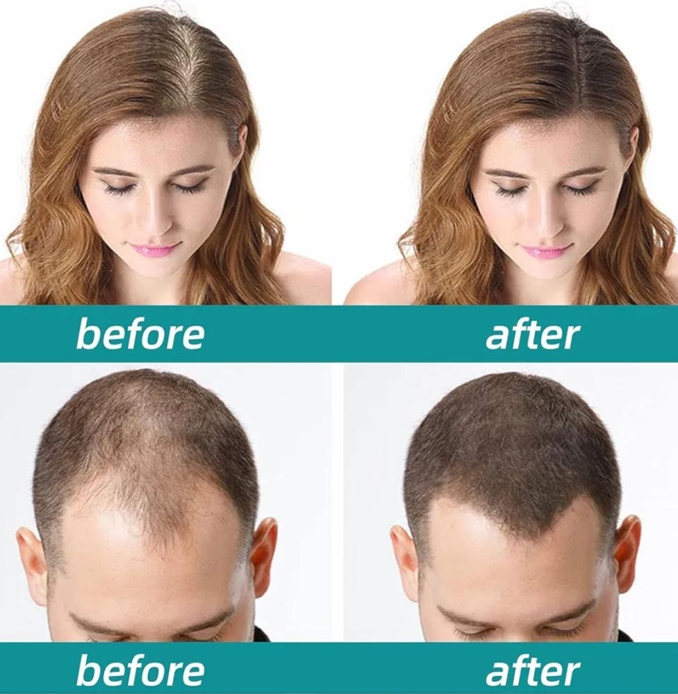 The Ordinary Multi-Peptide Hair Growth Serum for Hair Density -60ml 5
