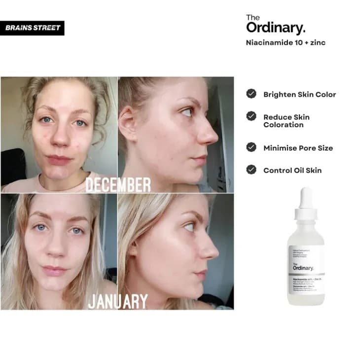 The Ordinary Niacinamide 10% Zinc 1% Serum 30 ML 4