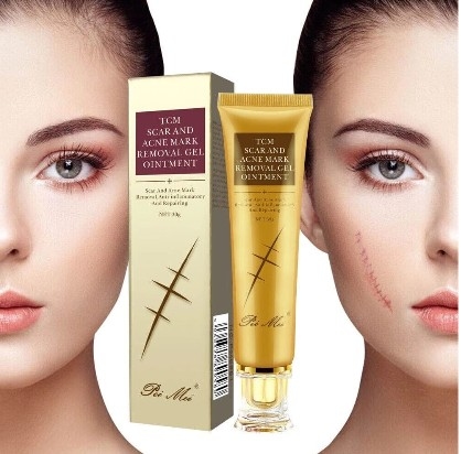 TCM SCAR AND ACNE MARK REMOVAL GEL OINTMENT 30 G, 2