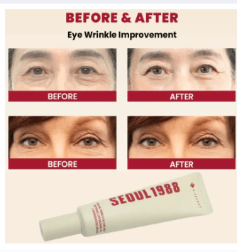 1988 Retinol Eye Cream – 30ml | Korean Skincare | Anti-Aging, Wrinkle Care, Brightening & Firming for All Skin Types 2