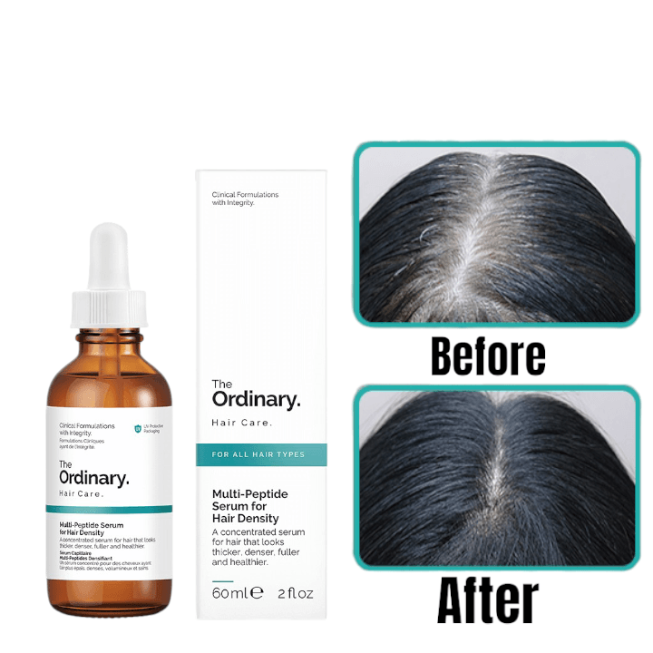 The Ordinary Multi-Peptide Hair Growth Serum for Hair Density -60ml 1