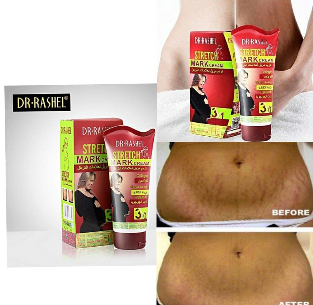 Dr. Rashel Stretch Mark Cream 150 Ml 2
