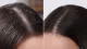 2pcs Oreva Derma Care Ketoconazole 2% Anti Dandruff OnOn Shampoo 100ml (GET FREE OLIVA SOAP) 5