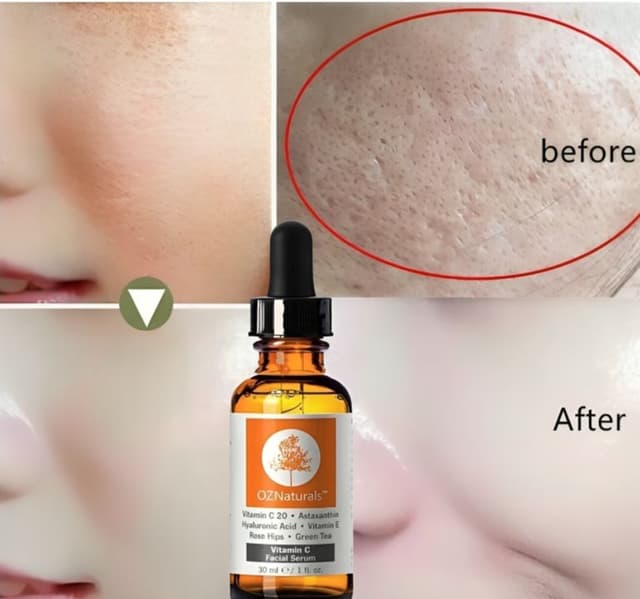 OZ Naturals Vitamin C Facial Serum With Hyaluronic Acid & Vitamin E -30ml/By Elysian Glow