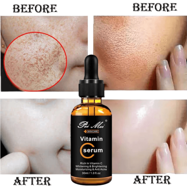 Pei Mei Hyaluronic Acid & Vitamin C Serum – 30ml | Brightening, Anti-Aging & Acne Care | Hydrating Face Serum for Glowing Skin / By Elysian Glow
