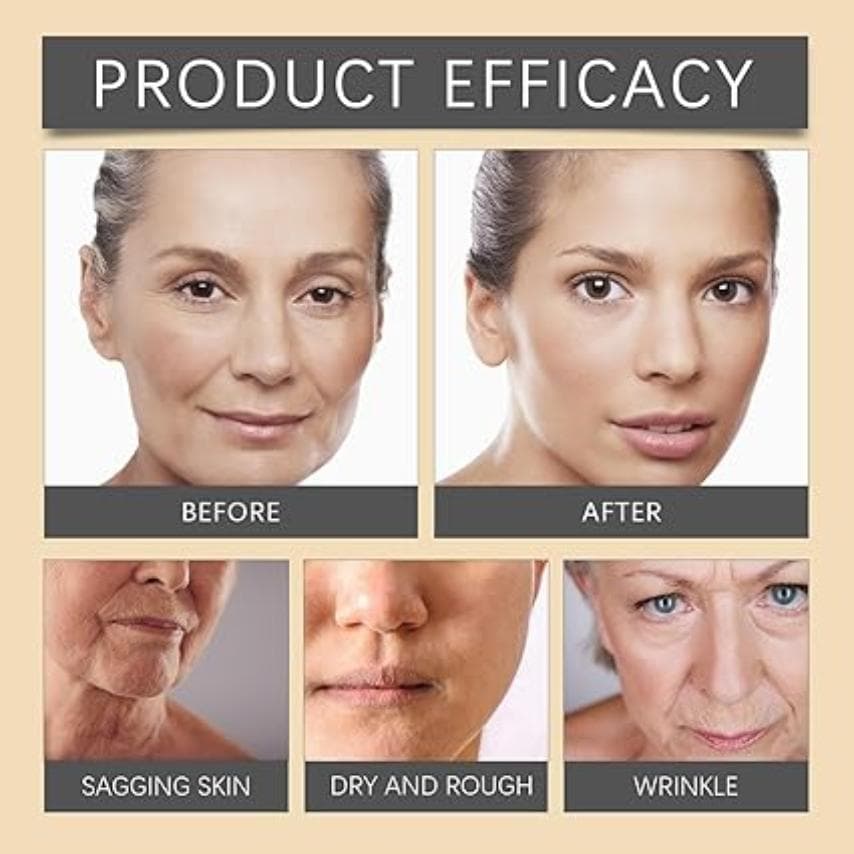 Botox Cream Bee Venom Wrinkle Cream, Bee Venom Skin Treatment Cream, Anti-Wrinkle Firming 6